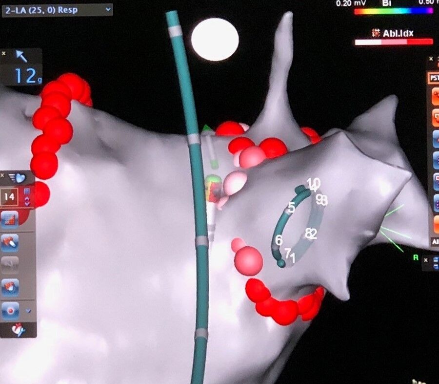 CIRCA Temperature Monitor – CIRCA's S-CATH™ Hot & Cold Esophageal Temperature  Monitoring System